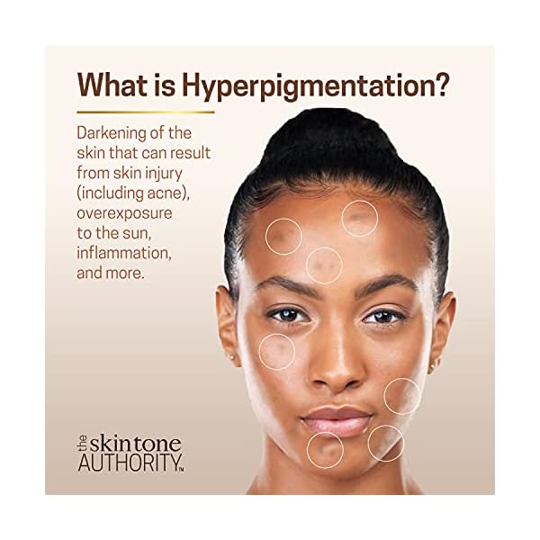 Ambi Fade Cream for Normal Skin, 2 oz (Pack of 3)