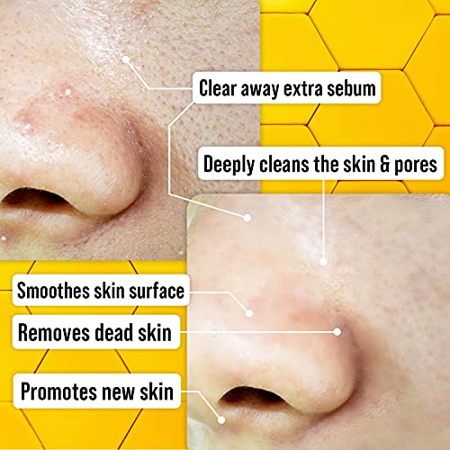 W Beauty Face Polish Peeling Gel Honey 120Ml 4.05 Fl. Oz. Gommage Skin Exfoliator Helps Dead Skin Removal Deep Cleansing Dull And Flaky Skin Clogged Pores #TOP3