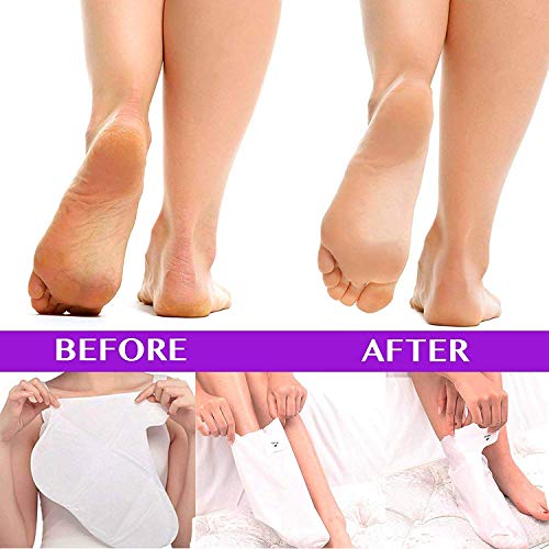 Exfoliating Foot Peel Mask - Two Pairs of Booties for Smooth and Soft Feet - Peeling Away Rough Heels Dead Skin Cells and Calluses - Lavender Scented Natural Formula for Silky Soft Feet