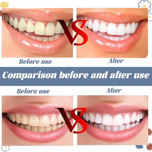 8 Stück Zahnsteinentferner,zahnstein entfernen, Zahnstein Selbst Entfernen, Zahnpolierer, Zahnbürste Teeth Stain Remover, Zahnbelag Entferner für Entfernt Verfärbungen, Plaque & Zahnstein