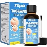 ZGjoib Skin Tag Remover,Wart Remover Freeze Off Liquid with 17% Salicylic Acid – Fast-Acting Freeze Off Treatment for Common & Plantar Warts,Flat Wart, Corns – for Feet, Hands & Body (1oz)
