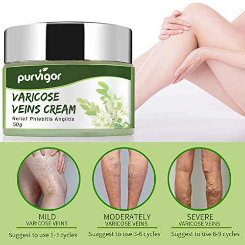 Purvigor Varicose Veins Cream, Varicose Vein Soothing Leg Cream, Reduce Swelling, Improve Blood Circulation, Tired And Heavy Legs Fast Relief, Vein Treatment For Legs #TOP4