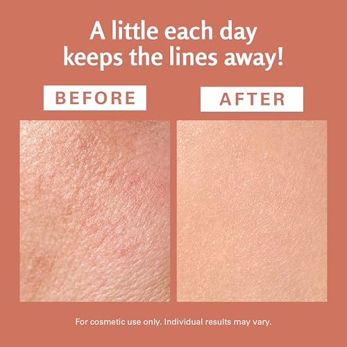 Image of Frankincense Essential Massage Oil for Scars, Stretch Marks & Fine Lines, Firming, Hydrating, Smoothing & Calming Formula with Collagen, Stem Cells, Lavender & Grapefruit, 8 fl oz, by M3
