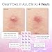 grace & stella Award Winning Pore Strip - Pimple Patches for Face - Heart Hydrocolloid Zit Stickers that Help Soothe & Conceal Breakouts - Cute Patches - Dermatologist-Tested Vegan (Heart, 36 Count)
