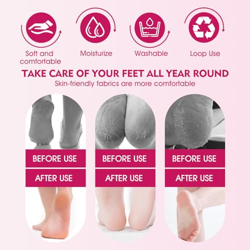 Silikon Socken für Creme,4 Stück Feuchtigkeitsspendende Socken+60g Fußcreme,Hornhaut Silikon Socken,Hornhautentferner Socken,Fußmaske Socken,Pflege für Rissige und Raue Haut,Hautfarbe+Rosa