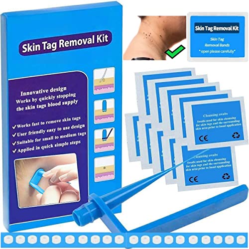 Image of Skin Tag Remover Kit (2-4mm) CONR Micro Painless DIY at Home with Cleansing Swabs Non Toxic Face Care Mole Wart Tool For Small To Medium Skin Tag (not for smaller than 2mm or flat skin tags)