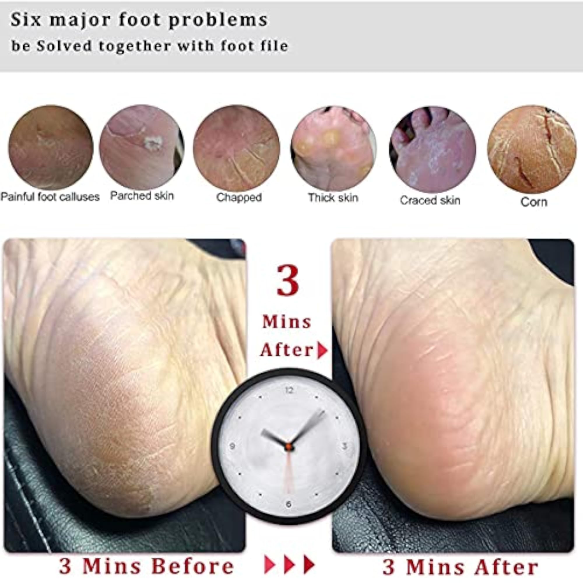 Professional Foot File Callus Remover Scrubber