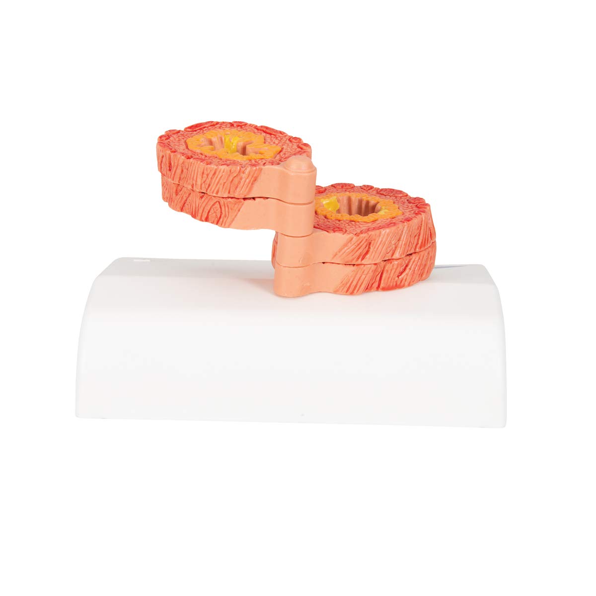 3B Scientific COPD model tkanki oskrzelowej darmowe oprogramowanie anatomiczne - 3B Smart Anatomy