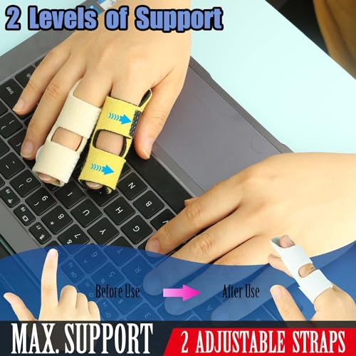 Kecartu 6 Pack Trigger Finger Splint, Finger Support Brace with Adjustable Fixing Belt for Straightening, Sprained, Tendinitis, Broken Finger Fits Index Finger,Middle Finger, Ring Finger (2 Straps) - Image 3