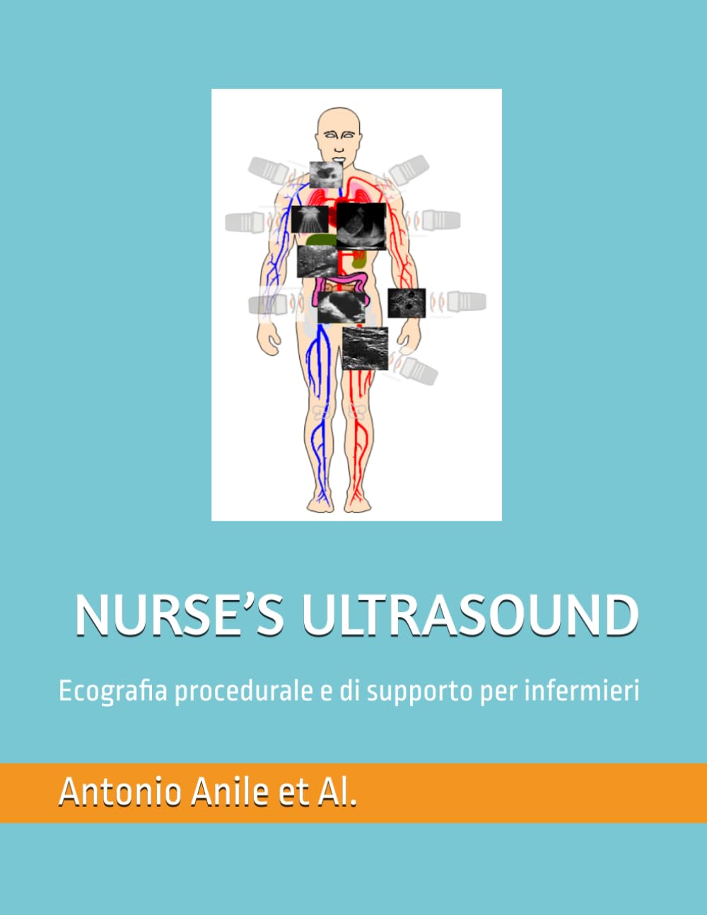 NURSE’S ULTRASOUND: Ecografia procedurale e di supporto per infermieri