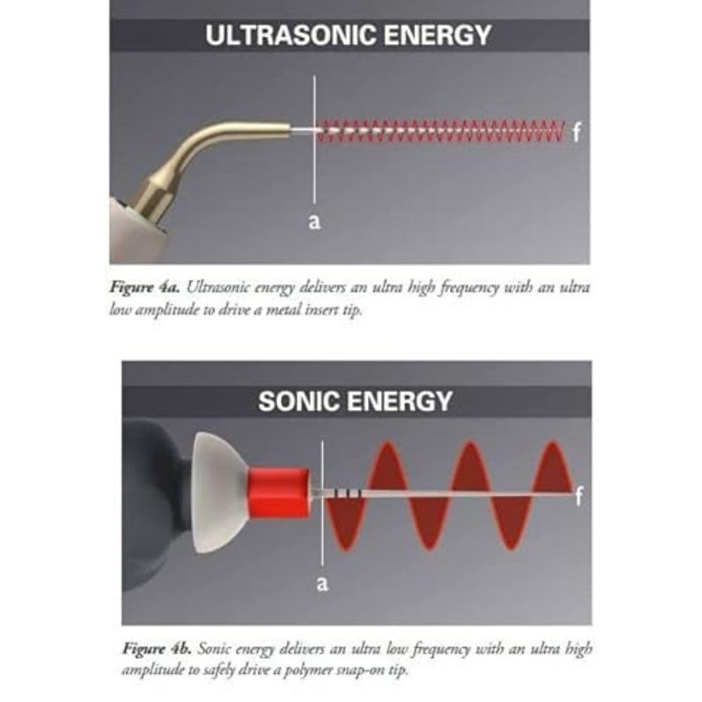 SuperEndo Tips for Sonic Irrigator – Medium (Red) | Endodontic Irrigation Tips for Root Canal Cleaning | Pack of Tips 1