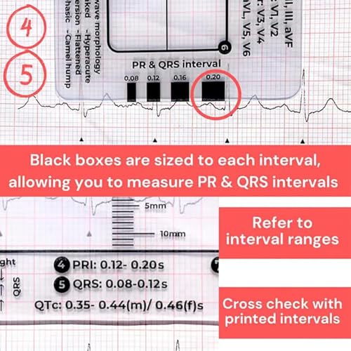 Regla ECG 7 Pasos Transparente de Plástico para Interpretar ECG miniatura 5