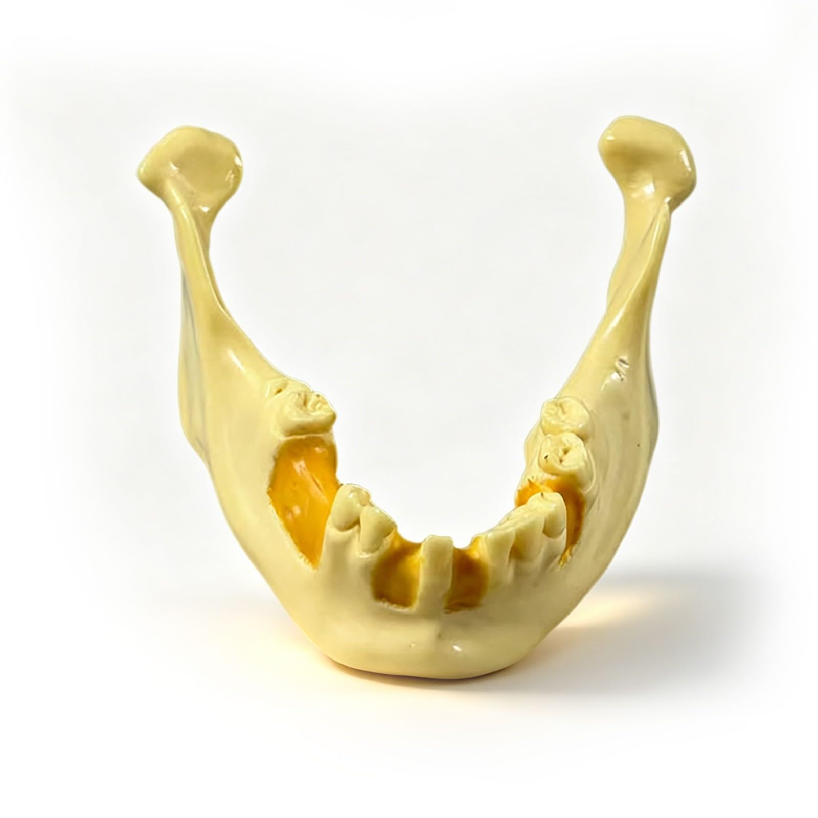 Model szczęki dentystycznej do praktyki implantologicznej, żuchwy do wiercenia i wkładania, idealny do treningu stomatologicznego i praktyki implantów zębów, do skutecznej praktyki