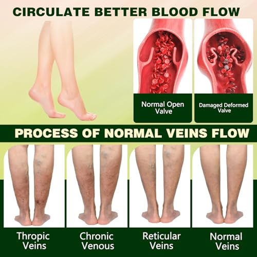 Professional Leg Circulation Cream，Fluid Ease Leg Soothing Cream，Edema Relief for Legs and Feet，Effectively reduce leg discomfort (1PC) Alternate view
