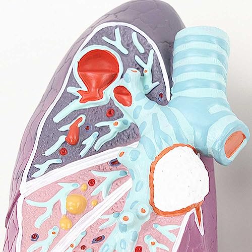 Modèle de poumon fumé pour formation médicale et démonstration des pathologies - 7
