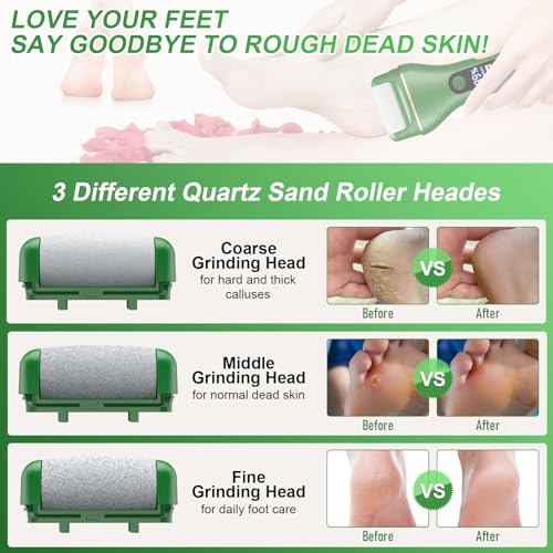Electric Callus Remover for Feet Rechargeable Portable Electronic Foot File Pedicure Tools 16 In 1 Foot Callus Remover Kit Foot Scrubber Professional Foot Care To Remove Dead Skin Hard Skin Dry Cracks - Thumbnail 4
