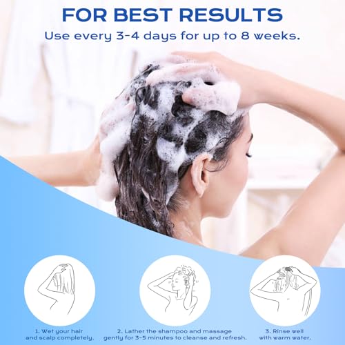 FYZMTL 1% Ketoconazole Anti-Dandruff Shampoo - Image 4
