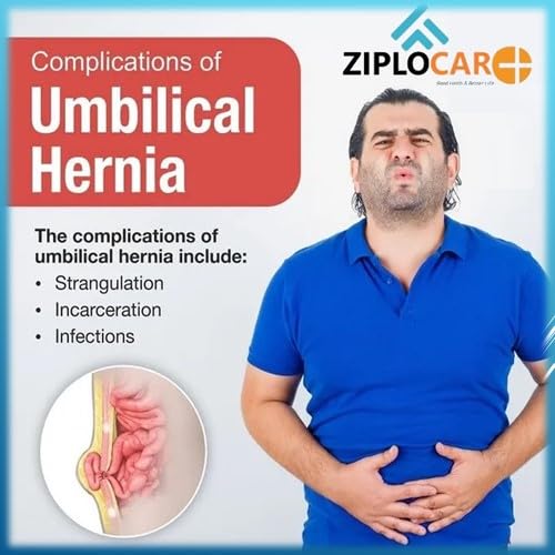 Faja para Hernia Umbilical Unisex con Almohadilla Extraíble miniatura 6
