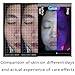 3D Skin Analyzer Machine, Professional Facial Moisture Analyzer, Skin Detector with LCD Display Screen, 8 Spectral Imaging Technology and 28 Million High-Definition Pixels, for Home Beauty Care