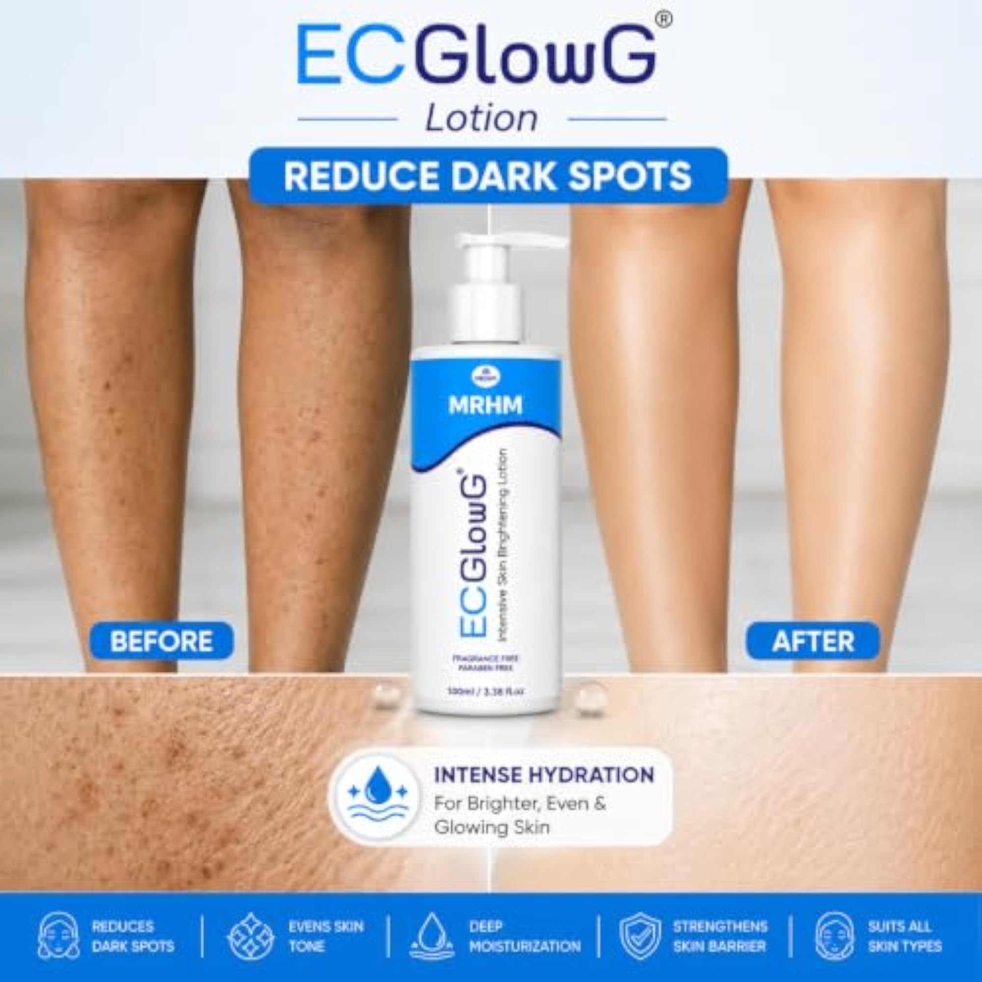 ECGlow G Body Lotion, Pigmentation Reducing Formula