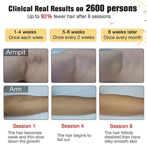 Permanent Hair Removal for Women & Men, IMENE Home Use Hair Removal Permanent Results- Ideal for Bikini, Legs, Arms, Armpits Hair Remover - Thumbnail 2