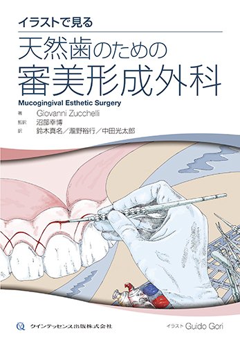 イラストで見る 天然歯のための審美形成外科 | Giovanni Zucchelli 