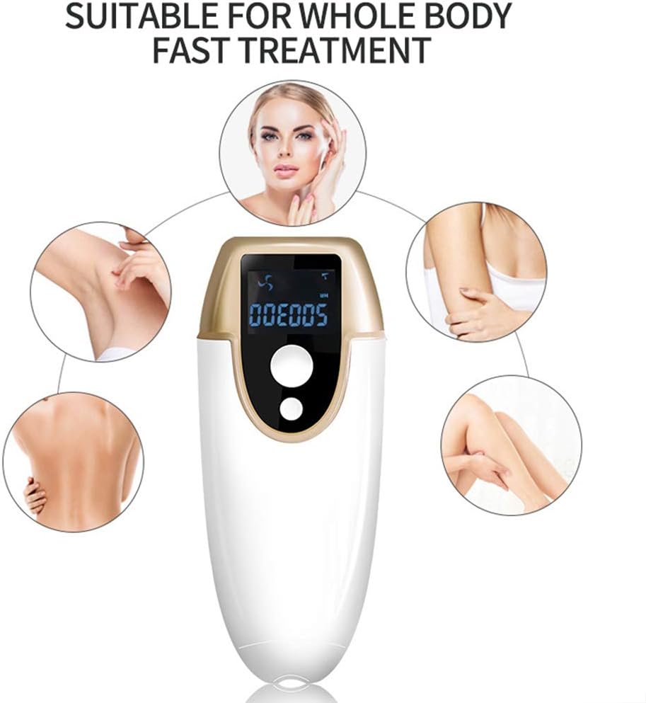 macchina di rimozione laser