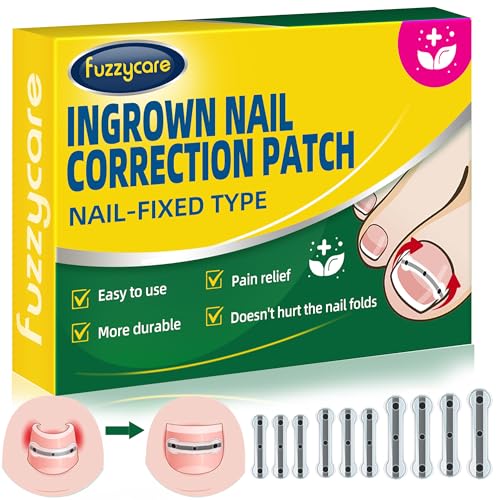Titanium Alloy Ingrown Toenail Treatment & Removal Kit for Quick Relief, Ingrown Toenail Removal Kit, Professional Ingrown Toenail Corrector, Ingrown Toenail Tools for Quick Relief, 10 Pcs