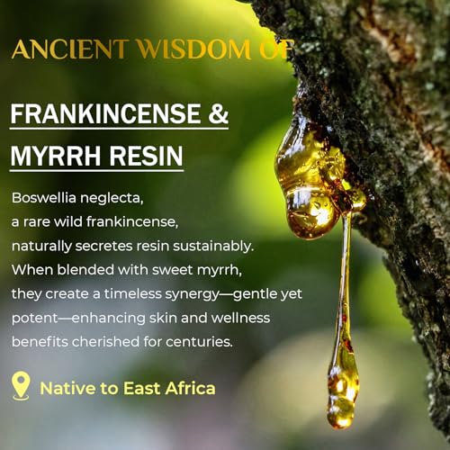 FeeMeFee Frankincense Balm 4oz, Frankincense Essential Oil with Myrrh for Soothing Relief, Muscle Relaxation, Boswellia Serrata, Olive Oil, Vitamin E, Moisturizer for Dry, Cracked Skin
