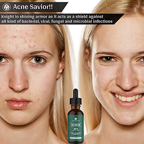 Naturenics Tea Tree Essential Oil-100% Usda Organic Melaleuca Alternifolia Therapeutic Grade- Natures Solution For Acne, Toenail, Lice, Hair, Face, Skin Problems-Roll On & Ebook-1 Fl Oz #TOP4