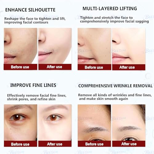 Urządzenie do ujędrniania twarzy Hifu z podwójnym uchwytem, ​​inteligentny, regulowany sprzęt kosmetyczny z ekranem dotykowym, łączy lifting twarzy, wygładzanie zmarszczek i