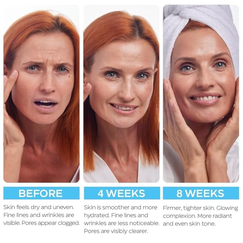 Image of Retinol Cream for Face 2-Pack - Anti-Aging Moisturizer with Hyaluronic Acid & Collagen, Day & Night Face Cream for Wrinkles & Fine Lines, 3.7 Oz (Pack of 2)