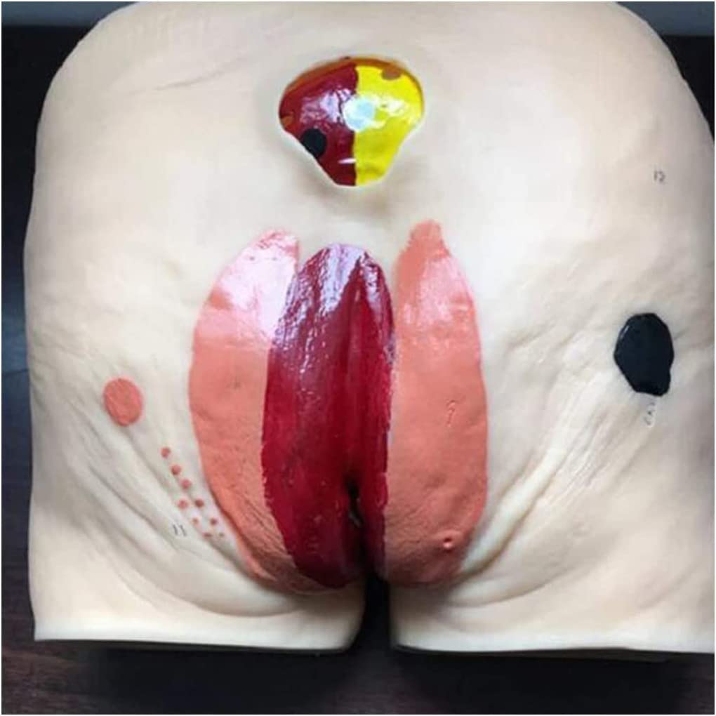 Outils de modèle d'enseignement, modèle de Soins des escarres de décubitus, modèle de Soins des escarres pour Personnes âgées, modèle d'enseignement du Mannequin, simulateur Humain