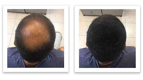 Miniatura 4 de FEBRON Bomba aplicadora de pulverización