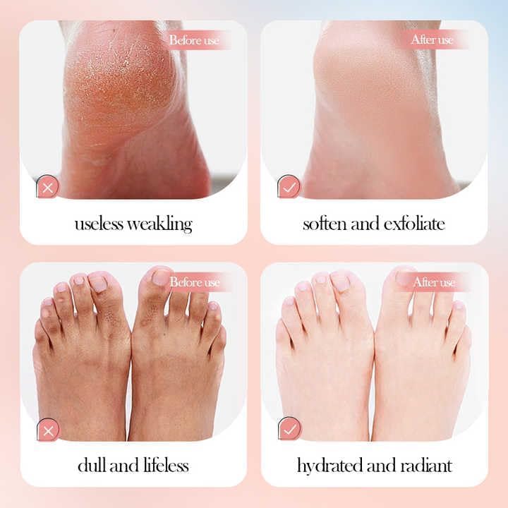 SWIREUK Exfoliating Foot Mask Foot Peel Mask Peeling Mask for Cracked Feet Dead Skin Remover Heel Peel Pedicure Removes Dry Skin & Hard Calluses Hydrates Dry Feet Foot Crack (Damask Rose) 3