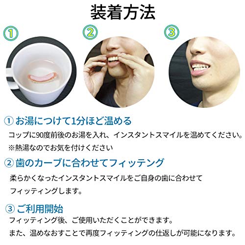 Instant Smile Teeth Small Deluxe Top Veneers Fake Cosmetic Dr Bailey's Fitting - Thumbnail 3
