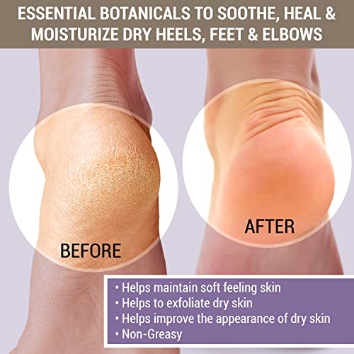 Triderma Cracked & Crusty™ Healthy Foot Cream Moisturizes, Softens And Heals Dry Feet, Cracked Heels And Dry Elbows With Salicylic Acid, Urea, Shea Butter, Ap4 Aloe And Vitamins, 4.2 Ounces #TOP4