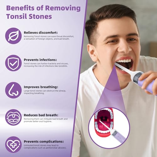 Image of Electronic Tonsil Stone Remover, Waterproof Vacuum Tonsil Stone Removal Kit with 4 Levels Suction Mode - Fight Bad Breath Oral Irrigator, Rechargeable Tonsil Cleaner - Hassle-Free Instant Suction