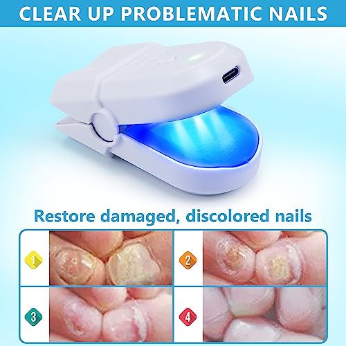 Toelight Nail Light Therapy by Tilcare - Image 4
