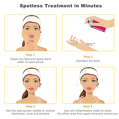 [Latest]Blackhead Remover Tool, Boxoyx 10 Pcs Professional Pimple Comedone Extractor Popper Tool Acne Removal Kit - Treatment For Pimples, Blackheads, Zit Removing, Forehead,Facial And Nose(Silver) #TOP7