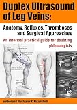 Duplex Ultrasound of Leg Veins: Anatomy, Refluxes, Thromboses, and Surgical Approaches: An Informal Practical Guide for Doubting Phlebologists