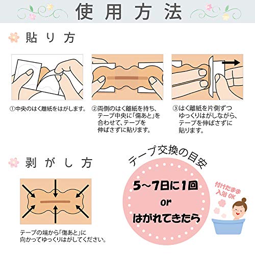 傷の治癒過程 手術の傷跡用おすすめテープ５選 いつまで貼る 看護師トリの学びブログ