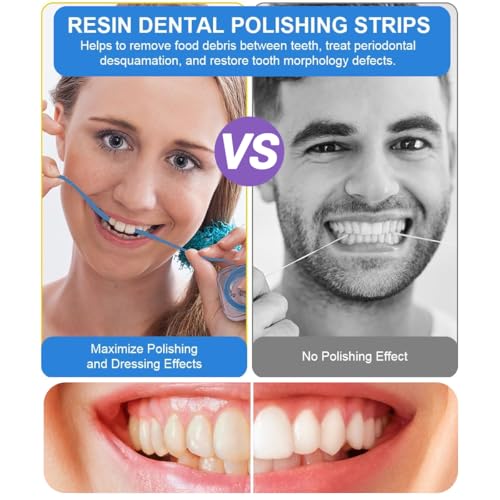 Ruvan 3 Bände Zahn Schleifpapier, Zahn Polierstreifen, Zur Reinigung Der Zahnzwischenräume, 20μm+30μm+50μm Grit Size Zahnreinigung Zwischenräume Set, Leicht Und Tragbar, Für Ihre Mundgesundheit Schutz