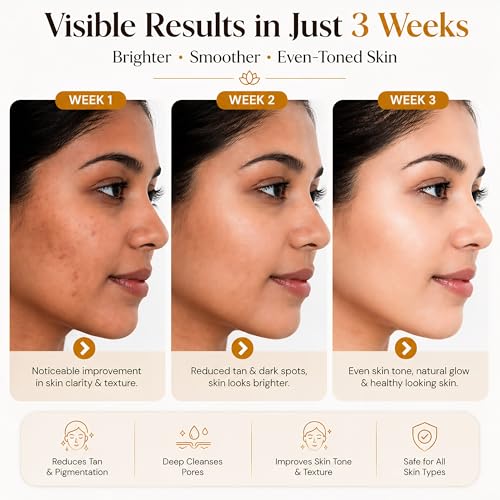 Image of Skin Brightening & Tan Removal Soap | Ayurvedic Bath Soap for Men & Women | Sandalwood, Saffron, Aloe Vera & Goat Milk | Helps Reduce Dark Spots & Uneven Skin Tone | Face & Body | Pack of 4 x 100g (400g)