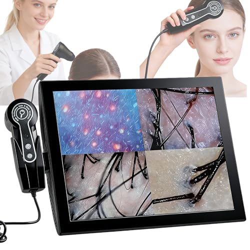 Professional 15-Inch Scalp-Camera for Salons & Spas High-Resolution Triple-Spectral Hair and Scalp Analysis Device with 50x/200x Magnification 4-Quadrant Comparison & Image Storage (Black)