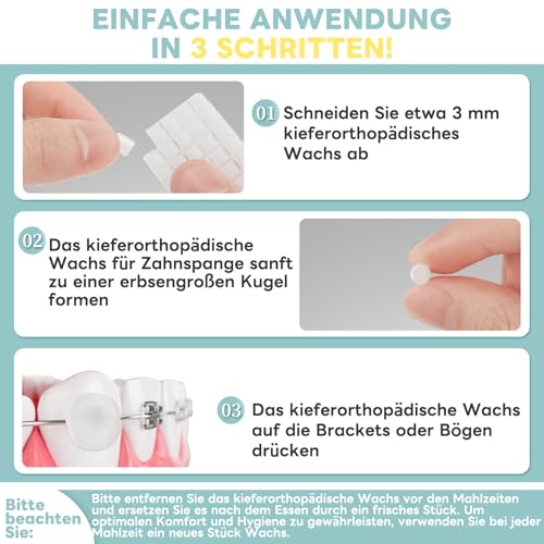 InhwRior Kieferorthopädie-Wachs, vorgeschnitten für einfache Handhabung, wissenschaftliche Dosierung. Jedes Stück bedeckt Brackets der Zahnspange.Lindert schnell Beschwerden durch Zahnspangen