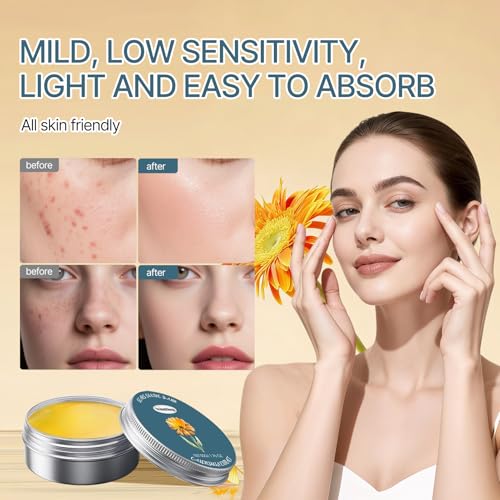 2 Stück Ringelblumensalbe,Natural Ingredients Miracle Balsam mit hohem Gehalt an Calendula Extrakt,Calendula Creme für Pflege bei trockener & gereizter Haut,Ringelblumen Creme,Natürlicher