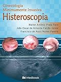 histeroscopia operatoria  HISTEROSCOPIA - GINECOLOGIA MINIMAMENTE INVASIVA