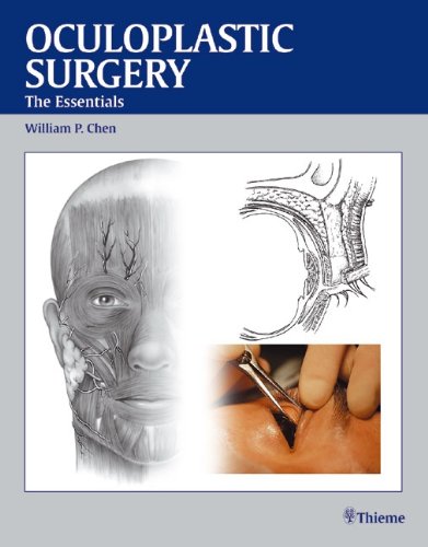 Buy Oculoplastic Surgery: The Essentials — BookShops.in
