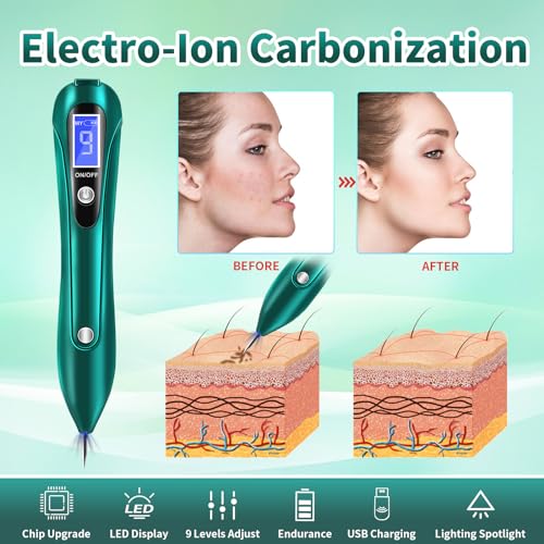CHRERNA Skin- Tag -Remover Pen, Mole Kit Removal Kit with 9 Strength Levels - Image 2